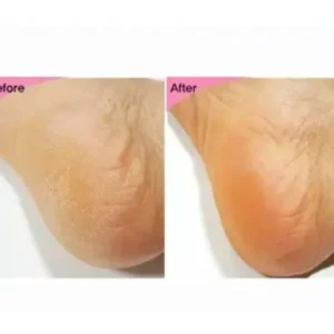 esfolio-foot-and-heel-peeling-mask-pic-1