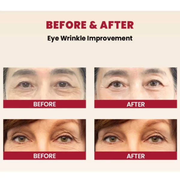 ksecret-seoul-1988-eye-cream-retinal-liposome-4percent-fermented-bean-30ml-pic-6