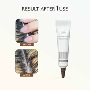 lador-scalp-scaling-spa-pic-5