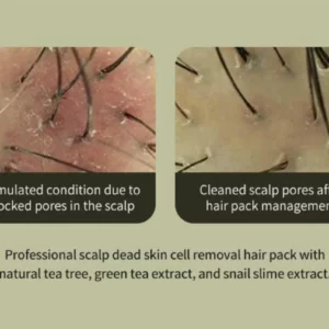 lador-tea-tree-scalp-clinic-hair-pack-200ml-pic-3