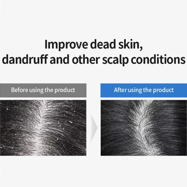 masil-5-probiotics-perfect-volume-shampoo-stick-pouch-pic-2