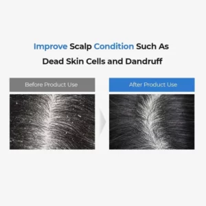 masil-5-probiotics-scalp-scaling-shampoo-stick-pouch-pic-1