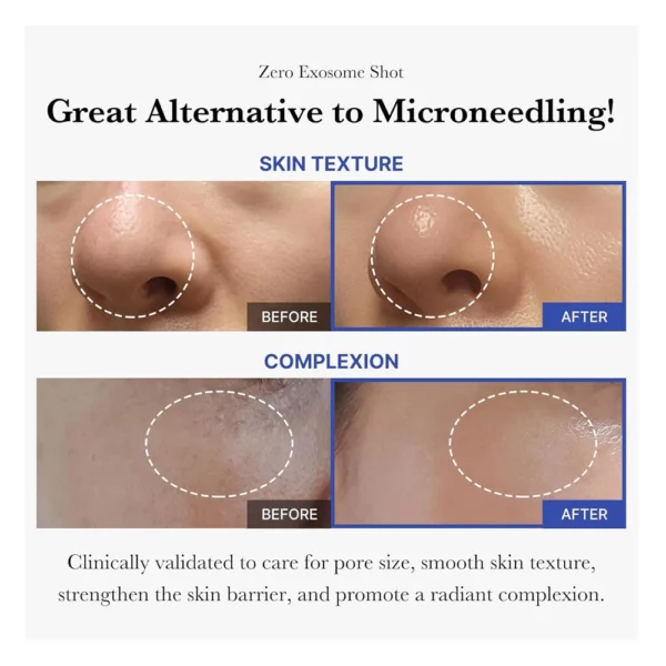 medicube-one-day-exosome-shot-pore-ampoule-2000-30ml-pic-4