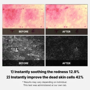 medicube-super-cica-pad-70pads-pic-5