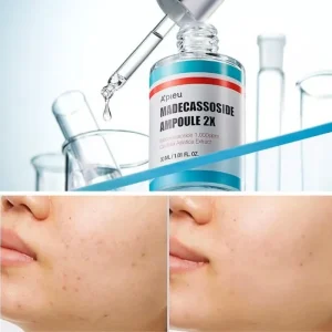 apieu-madecassoside-ampoule-2x-30ml-pic-3