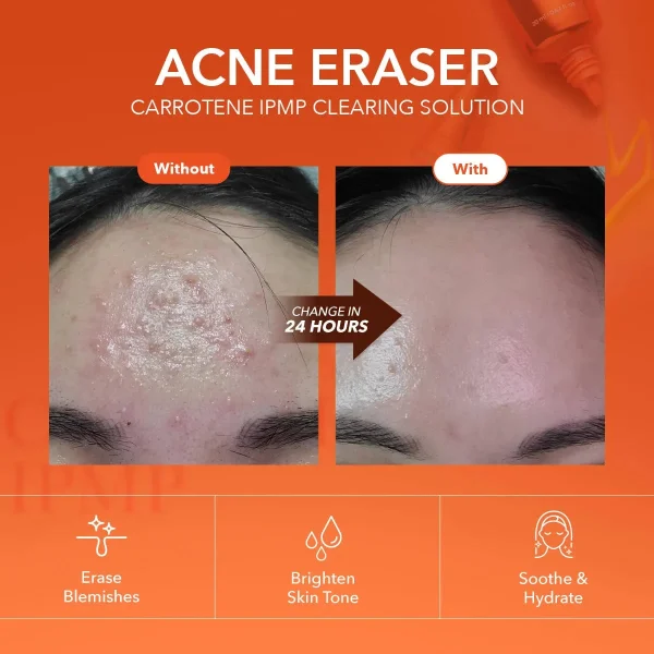 aprilskin-carrotene-ipmp-clearing-solution-20ml-pic-3