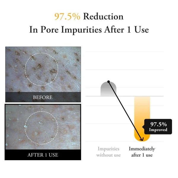 aprilskin-real-calendula-peel-off-pack-100g-pic-3