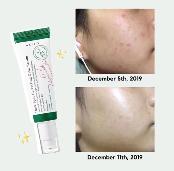 axis-y-dark-spot-correcting-glow-serum-50ml-pic-10