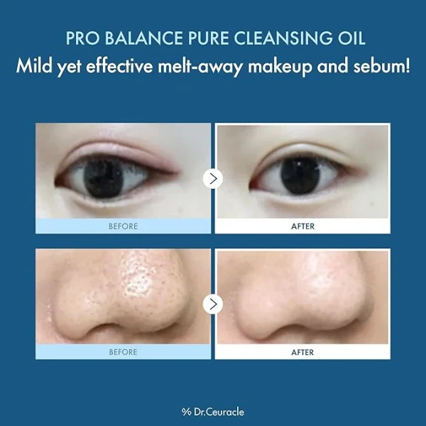 dr-ceuracle-pro-balance-pure-deep-cleansing-oil-155ml-pic-5