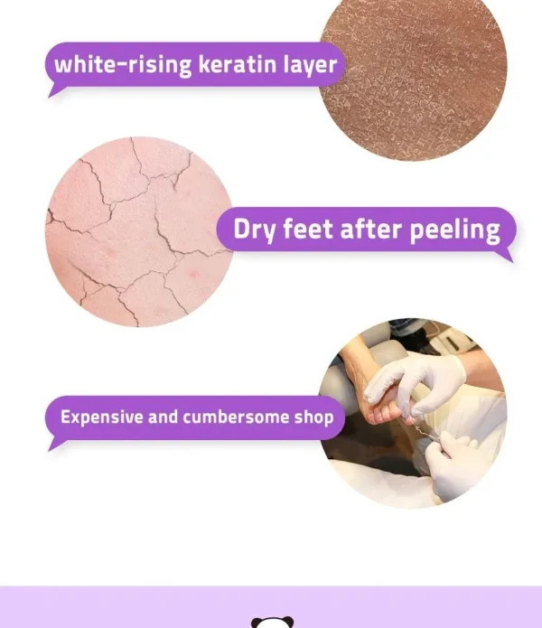 esfolio-3ha-foot-peeling-mask-20ml-pic-5