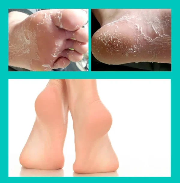 missha-wonder-foot-peeling-mask-50ml-pic-5