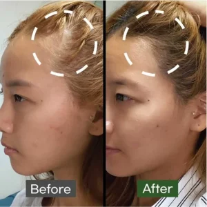 some-by-mi-cica-peptide-anti-hair-loss-derma-scalp-treatment-50ml-pic-4