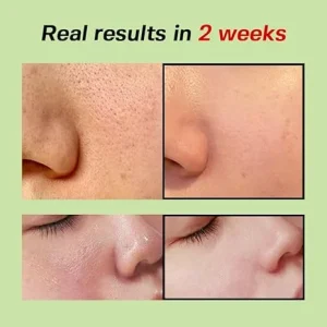 sungboon-editor-green-tomato-pore-lifting-ampoule-30ml-pic-6