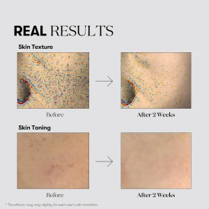 vt-cosmetics-tx-toning-toner-200ml-pic-3