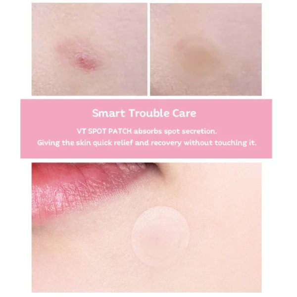 vt-cosmetics-vt-spot-patch-48pcs-pic-7