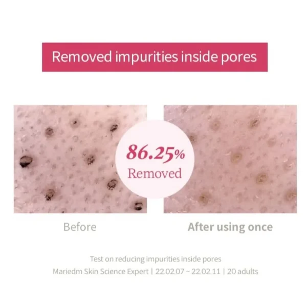 im-from-beet-purifying-mask-70g-pic-2