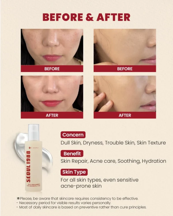 ksecret-seoul-1988-essence-snail-mucin-97percent-rice-100ml-pic-4