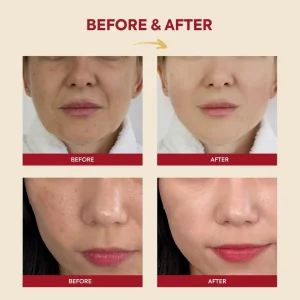ksecret-seoul-1988-essence-snail-mucin-97percent-rice-100ml-pic-5