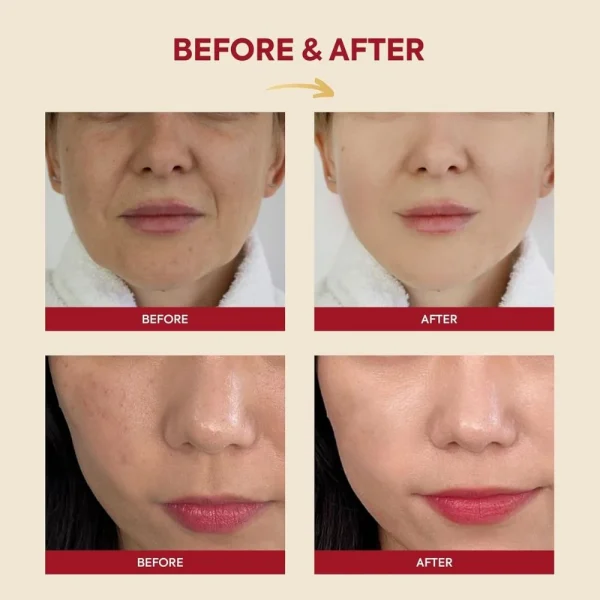ksecret-seoul-1988-essence-snail-mucin-97percent-rice-100ml-pic-5