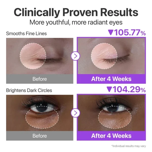 numbuzin-no9-nad-retinol-volumetox-eye-cream-10ml-pic-4