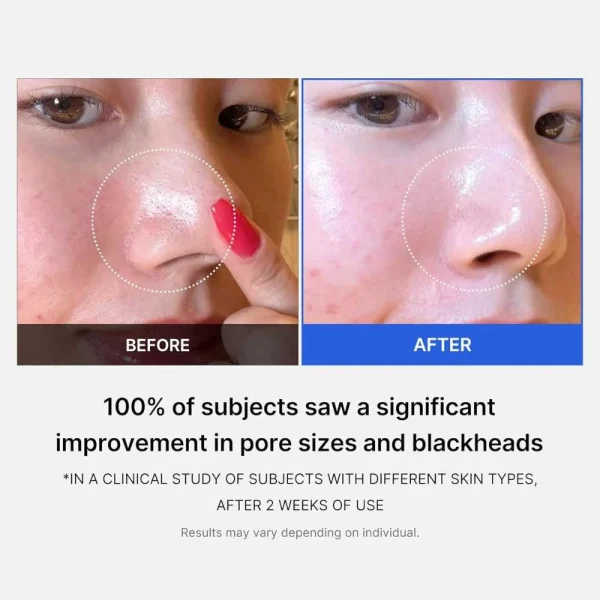 medicube-zero-pore-pad-20-70pads-pic-4