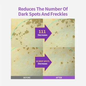 sungboon-editor-meoru-podo-vitac-dark-spot-ampoule-30ml-pic-4