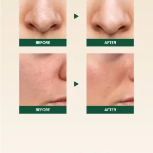 ksecret-seoul-1988-cleansing-foam-pine-cica-1percent-probiotics-mini-20ml-pic-2