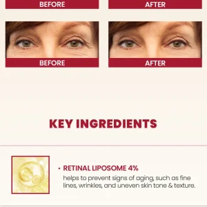 ksecret-seoul-1988-eye-cream-retinal-liposome-4percent-fermented-bean-mini-10ml-pic-4