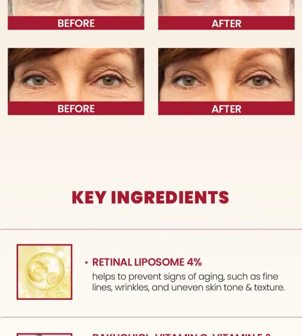 ksecret-seoul-1988-eye-cream-retinal-liposome-4percent-fermented-bean-mini-10ml-pic-4